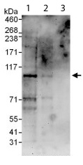 Western blot - Anti-EPC1 antibody (AB112043), expandable thumbnail