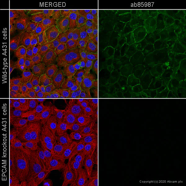 Immunocytochemistry/ Immunofluorescence - Anti-EpCAM antibody [323/A3] (AB85987)