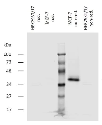 Western blot - Anti-EpCAM antibody [323/A3] (AB85987)