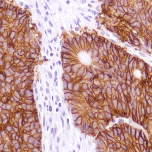 Immunohistochemistry (Formalin/PFA-fixed paraffin-embedded sections) - Anti-EpCAM antibody [4A7] - C-terminal (AB224826), expandable thumbnail