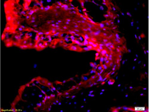 Immunohistochemistry (Formalin/PFA-fixed paraffin-embedded sections) - Anti-EpCAM antibody (AB216832), expandable thumbnail