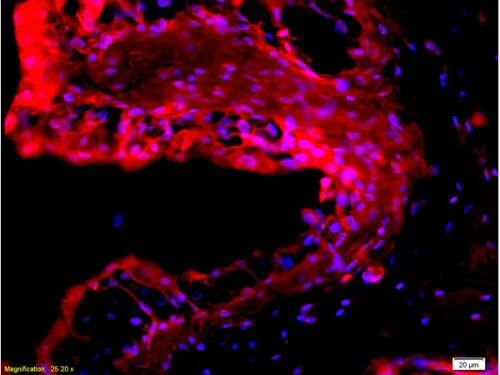 Immunohistochemistry (Formalin/PFA-fixed paraffin-embedded sections) - Anti-EpCAM antibody (AB216832)