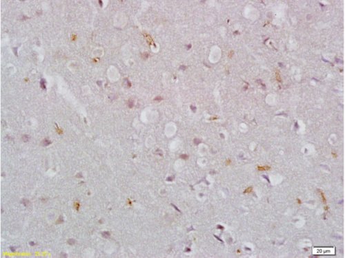 Immunohistochemistry (Formalin/PFA-fixed paraffin-embedded sections) - Anti-EpCAM antibody (AB216832), expandable thumbnail