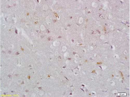 Immunohistochemistry (Formalin/PFA-fixed paraffin-embedded sections) - Anti-EpCAM antibody (AB216832)