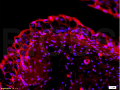 Immunohistochemistry (Formalin/PFA-fixed paraffin-embedded sections) - Anti-EpCAM antibody (AB216832), expandable thumbnail