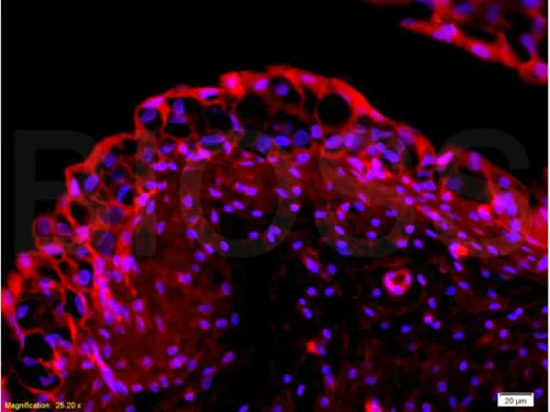 Immunohistochemistry (Formalin/PFA-fixed paraffin-embedded sections) - Anti-EpCAM antibody (AB216832)