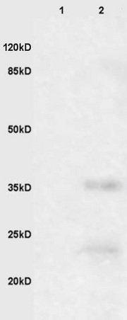 Western blot - Anti-EpCAM antibody (AB216832), expandable thumbnail