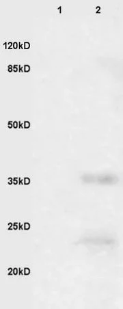 Western blot - Anti-EpCAM antibody (AB216832)