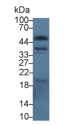 Western blot - Anti-EpCAM antibody (AB231223)