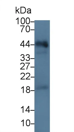 Western blot - Anti-EpCAM antibody (AB231223)