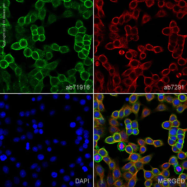 Immunocytochemistry/ Immunofluorescence - Anti-EpCAM antibody (AB71916)