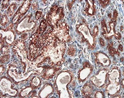 Immunohistochemistry (Formalin/PFA-fixed paraffin-embedded sections) - Anti-EpCAM antibody (AB71916)