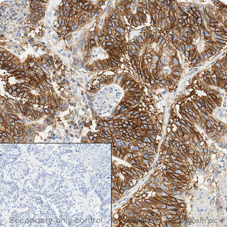 Immunohistochemistry (Formalin/PFA-fixed paraffin-embedded sections) - Anti-EpCAM antibody (AB71916)