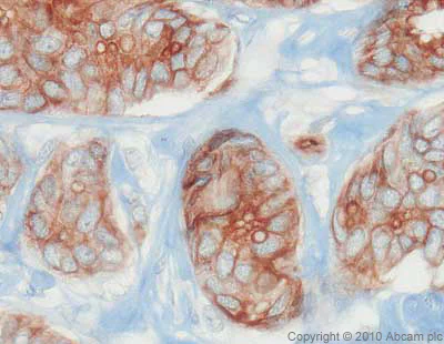 Immunohistochemistry (Formalin/PFA-fixed paraffin-embedded sections) - Anti-EpCAM antibody (AB71916)