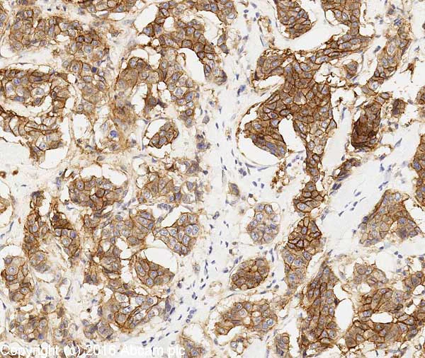Immunohistochemistry (Formalin/PFA-fixed paraffin-embedded sections) - Anti-EpCAM antibody (AB71916)