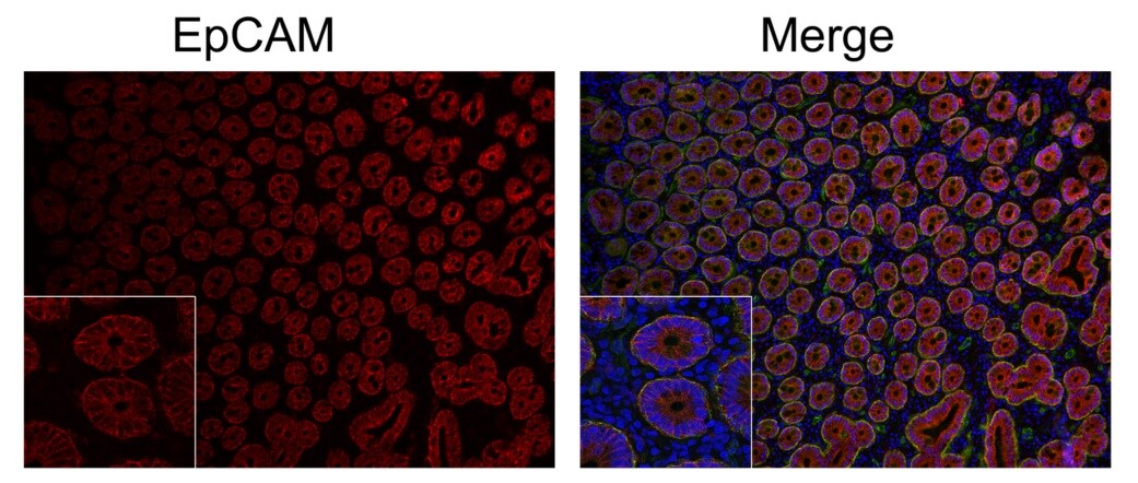 Anti-EpCAM antibody [AUA1] (ab308057) | Abcam