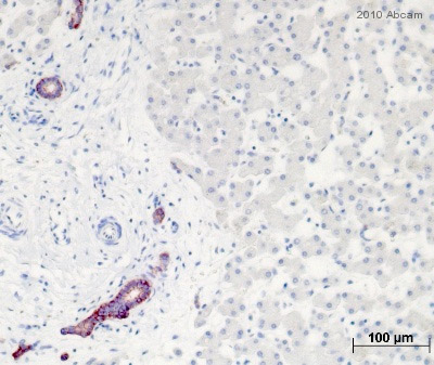 Immunohistochemistry (Formalin/PFA-fixed paraffin-embedded sections) - Anti-EpCAM antibody [Ber-EP4] (AB7504)