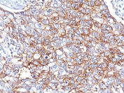 Immunohistochemistry (Formalin/PFA-fixed paraffin-embedded sections) - Anti-EpCAM antibody [Cocktail EGP40/826/837/1110/1120] (AB216136), expandable thumbnail