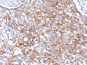 Immunohistochemistry (Formalin/PFA-fixed paraffin-embedded sections) - Anti-EpCAM antibody [Cocktail EGP40/826/837/1110/1120] (AB216136)
