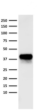 Western blot - Anti-EpCAM antibody [Cocktail EGP40/826/837/1110/1120] (AB216136), expandable thumbnail