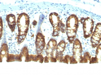 Immunohistochemistry (Formalin/PFA-fixed paraffin-embedded sections) - Anti-EpCAM antibody [EGP40/1110] (AB233919), expandable thumbnail