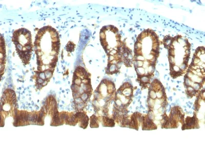 Immunohistochemistry (Formalin/PFA-fixed paraffin-embedded sections) - Anti-EpCAM antibody [EGP40/1110] (AB233919)