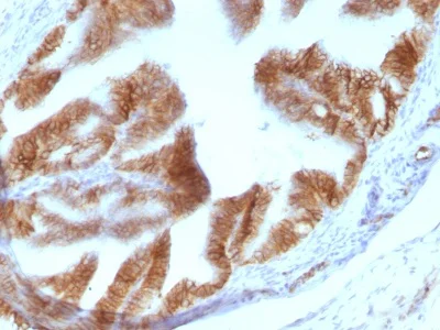 Immunohistochemistry (Formalin/PFA-fixed paraffin-embedded sections) - Anti-EpCAM antibody [EGP40/1110] (AB233919)