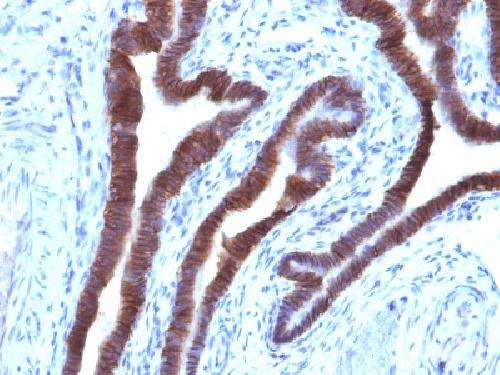 Immunohistochemistry (Formalin/PFA-fixed paraffin-embedded sections) - Anti-EpCAM antibody [EGP40/1110] - BSA and Azide free (AB212580)
