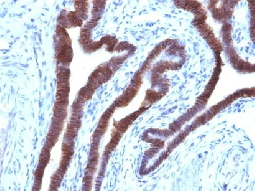Immunohistochemistry (Formalin/PFA-fixed paraffin-embedded sections) - Anti-EpCAM antibody [EGP40/1110] - BSA and Azide free (AB212580)