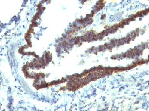 Immunohistochemistry (Formalin/PFA-fixed paraffin-embedded sections) - Anti-EpCAM antibody [EGP40/1110] - BSA and Azide free (AB212580)