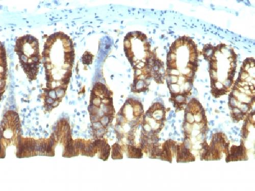 Immunohistochemistry (Formalin/PFA-fixed paraffin-embedded sections) - Anti-EpCAM antibody [EGP40/1110] - BSA and Azide free (AB212580)