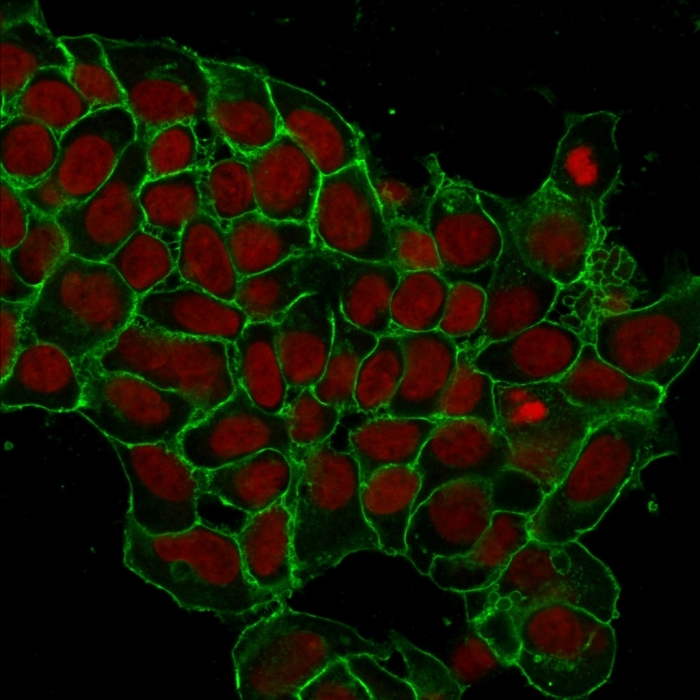 Immunocytochemistry - Anti-EpCAM antibody [EGP40/1372] (AB218448), expandable thumbnail