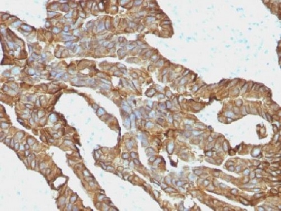 Immunohistochemistry (Formalin/PFA-fixed paraffin-embedded sections) - Anti-EpCAM antibody [EGP40/1372] (AB218448), expandable thumbnail