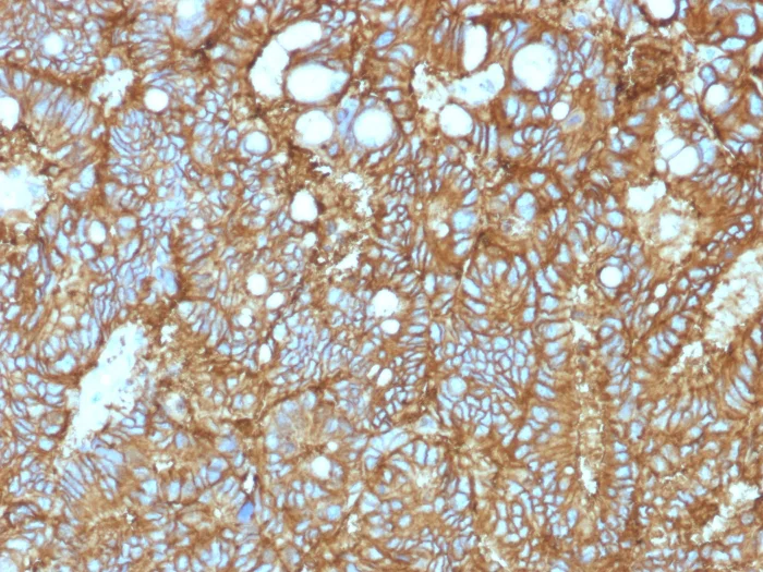 Immunohistochemistry (Formalin/PFA-fixed paraffin-embedded sections) - Anti-EpCAM antibody [EGP40/1372] (AB218448)