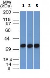 Western blot - Anti-EpCAM antibody [EGP40/1372] (ab218448), expandable thumbnail