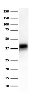Western blot - Anti-EpCAM antibody [EGP40/1372] (ab218448), expandable thumbnail