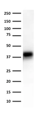Western blot - Anti-EpCAM antibody [EGP40/1372] (AB218448)