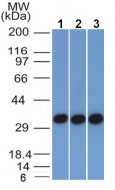 Western blot - Anti-EpCAM antibody [EGP40/1372] - BSA and Azide free (AB218908), expandable thumbnail