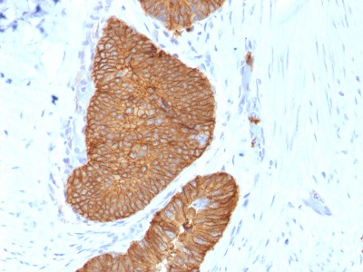 Immunohistochemistry (Formalin/PFA-fixed paraffin-embedded sections) - Anti-EpCAM antibody [EGP40/1384] - BSA and Azide free (AB218910)