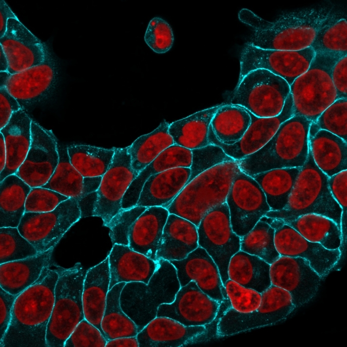 Immunocytochemistry - Anti-EpCAM antibody [EGP40/1556R] (AB218455), expandable thumbnail