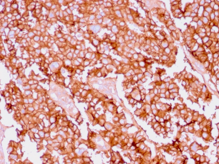 Immunohistochemistry (Formalin/PFA-fixed paraffin-embedded sections) - Anti-EpCAM antibody [EGP40/1556R] (AB218455), expandable thumbnail