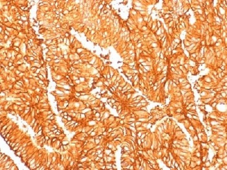 Immunohistochemistry (Formalin/PFA-fixed paraffin-embedded sections) - Anti-EpCAM antibody [EGP40/1556R] (AB218455), expandable thumbnail