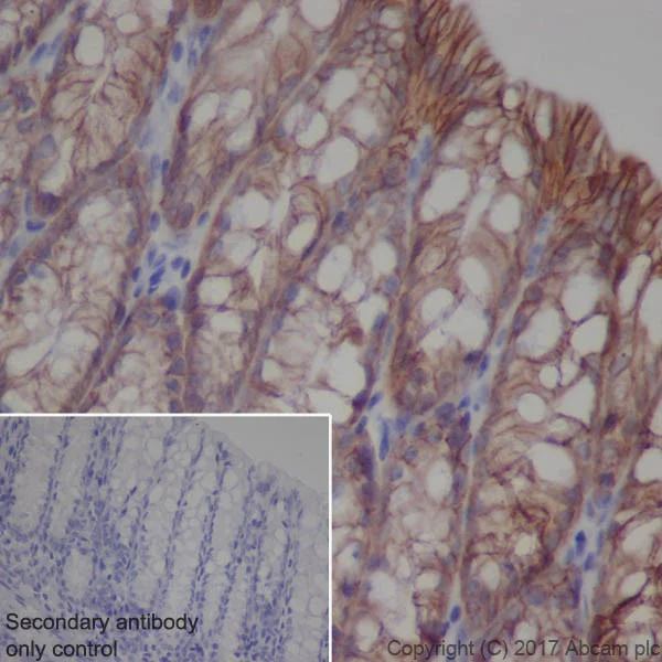 Immunohistochemistry (Formalin/PFA-fixed paraffin-embedded sections) - Anti-EpCAM antibody [EPR20532-222] (AB213500)