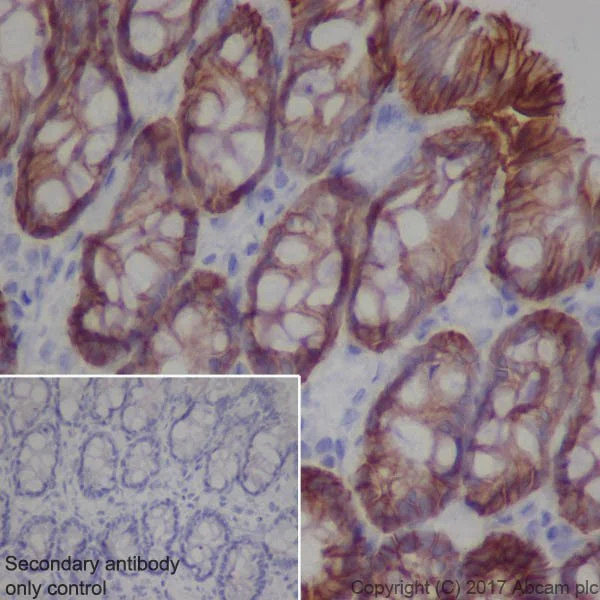 Immunohistochemistry (Formalin/PFA-fixed paraffin-embedded sections) - Anti-EpCAM antibody [EPR20532-222] (AB213500)