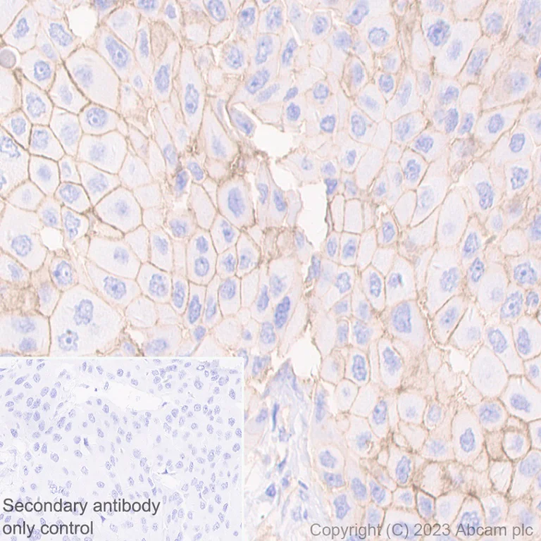 Immunohistochemistry (Formalin/PFA-fixed paraffin-embedded sections) - Anti-EpCAM antibody [EPR20532-222] (AB213500)