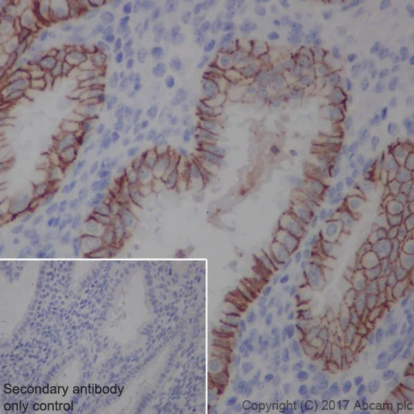 Immunohistochemistry (Formalin/PFA-fixed paraffin-embedded sections) - Anti-EpCAM antibody [EPR20532-222] - BSA and Azide free (AB232539)