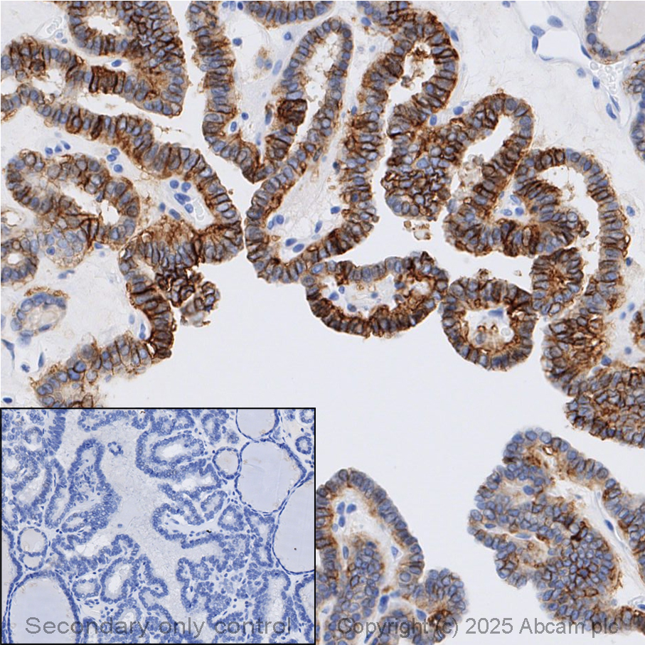 Anti-EpCAM antibody [EPR20532-225]
