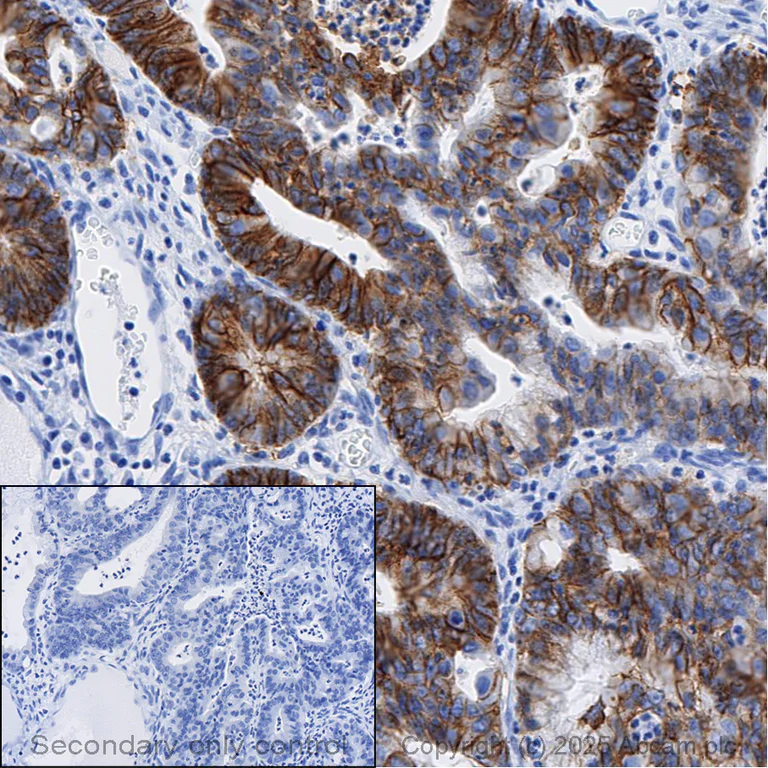 Immunohistochemistry (Formalin/PFA-fixed paraffin-embedded sections) - Anti-EpCAM antibody [EPR20532-225] (AB223582)