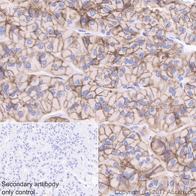 Immunohistochemistry (Formalin/PFA-fixed paraffin-embedded sections) - Anti-EpCAM antibody [EPR20532-225] (AB223582), expandable thumbnail