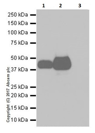 Immunoprecipitation - Anti-EpCAM antibody [EPR20532-225] (ab223582), expandable thumbnail